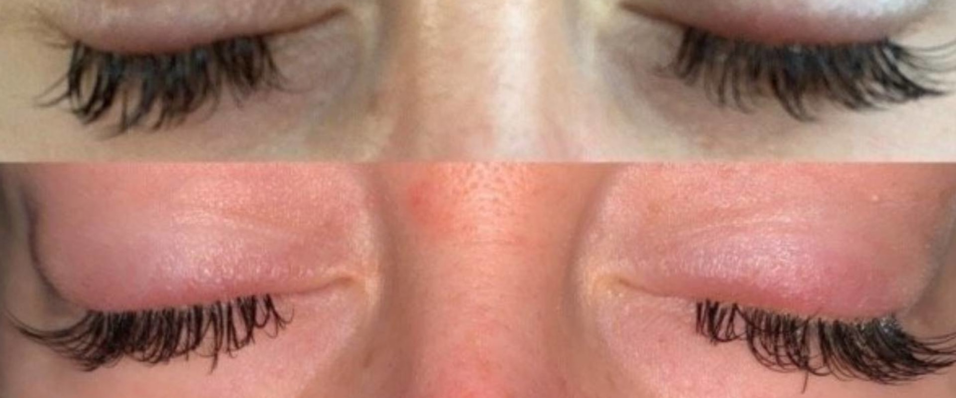 Are eyelash extensions glued to eyelids?