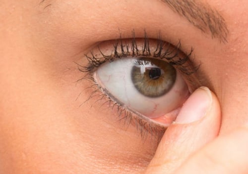 Where do eyelashes go when they get stuck in your eye?